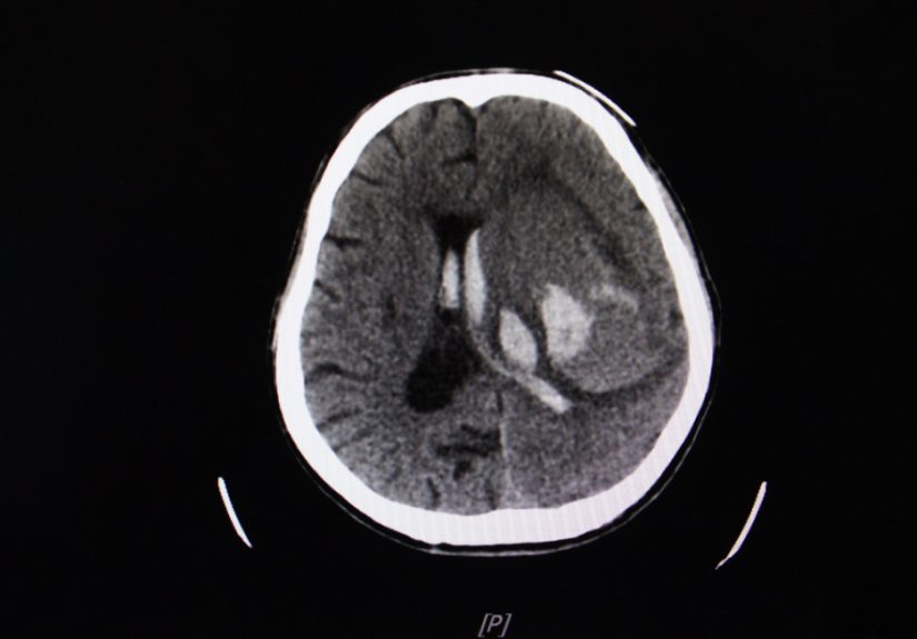 A Radiologist Saved My Father’s Life