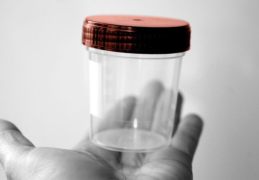Does Medicare Cover Parasite Stool Tests?