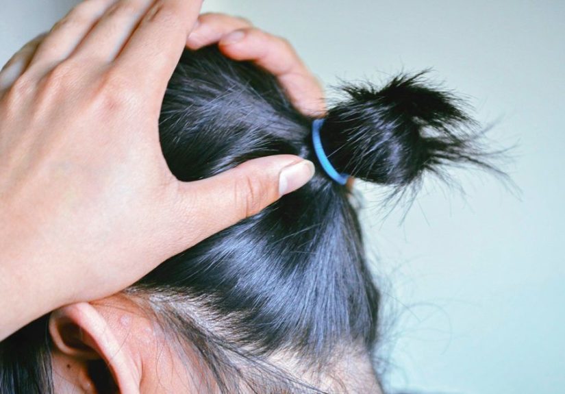 Laser Treatment for Hair Loss: Does It Work?