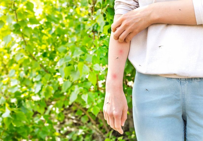 Unbelievable Hacks for How to Keep Mosquitoes Away For Good