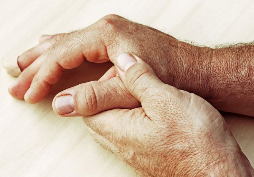 Collagen Vascular Disease: Causes, Symptoms & Treatments