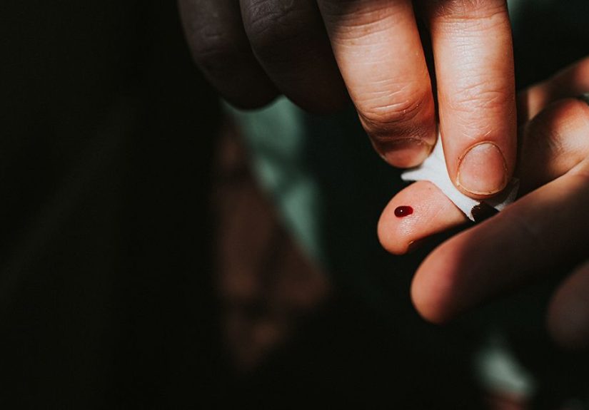 Do They Check for HIV Before Surgery? 3 Things to Know