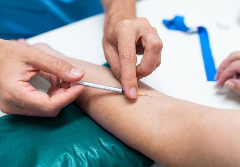 Does Medicare Cover a PPD Test? What to Know