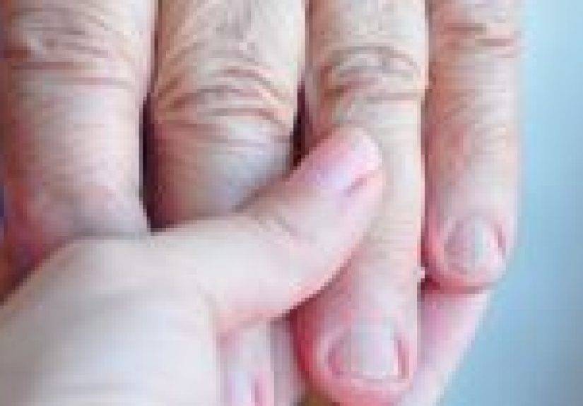 Drug-Induced Tremor: Symptoms, Diagnosis & Treatments