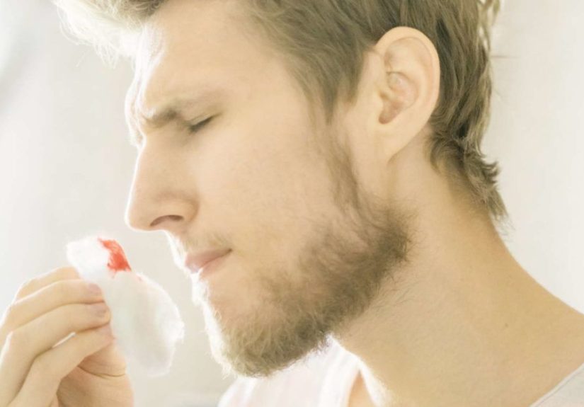 Hemophilia: Coagulation and how blood clots