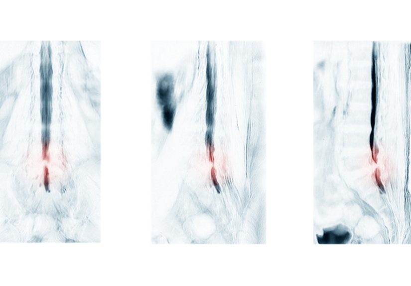 How a Patient’s Passing Changed This Radiologist