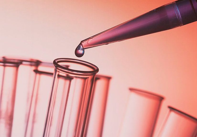 Multiple myeloma and hypercalcemia: Link, causes, and more
