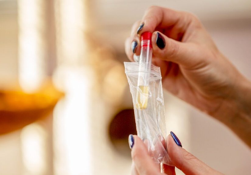 Protein in Urine: Why You Shouldn’t Ignore It in Pregnancy