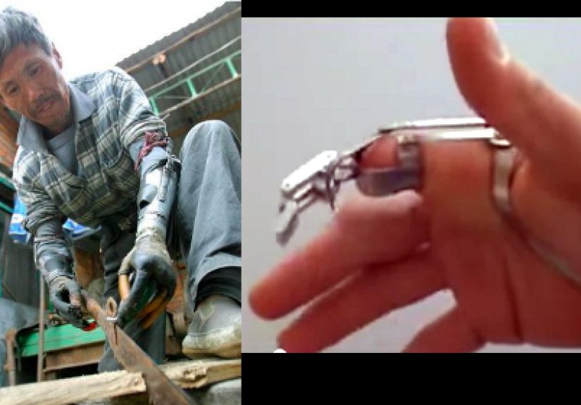 Replacing A Finger Or An Arm In The Hacker Tradition