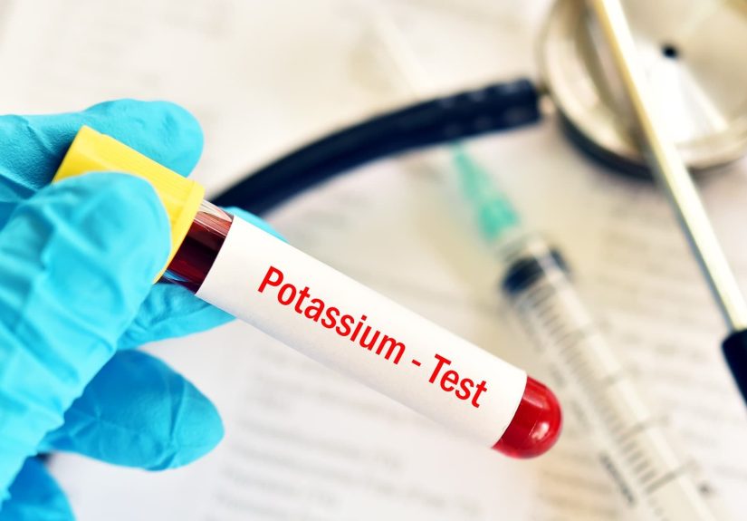 What Is High Potassium?