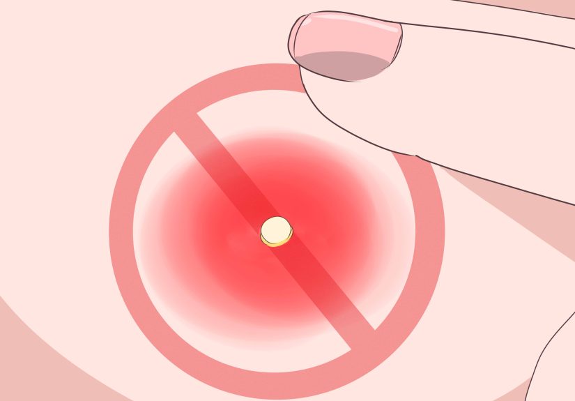 3 Easy Ways to Remove Pus from a Wound