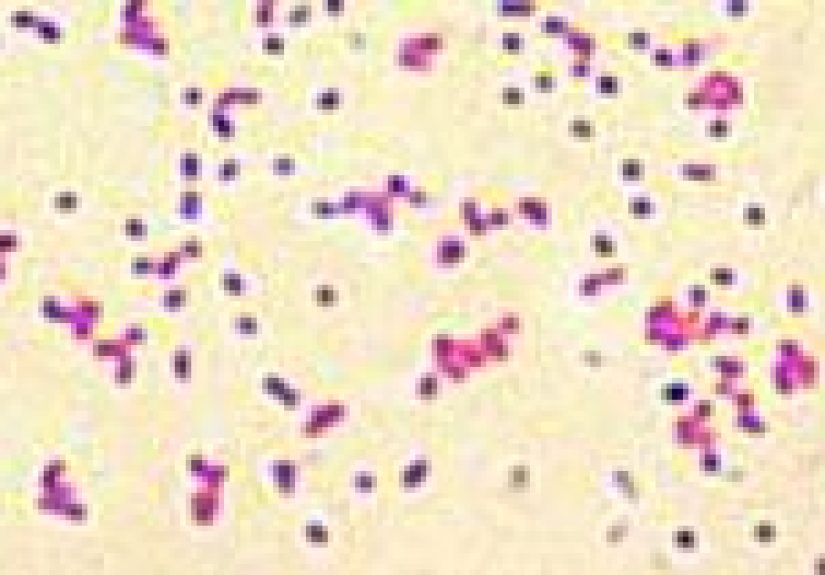 Brucellosis: Overview, Symptoms & Diagnosis