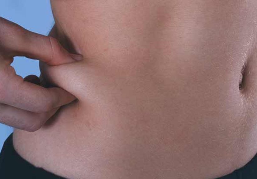 Humira Injection Sites: What You Should Know