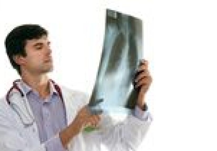 Kaposi Sarcoma: Types, Diagnosis and Treatments