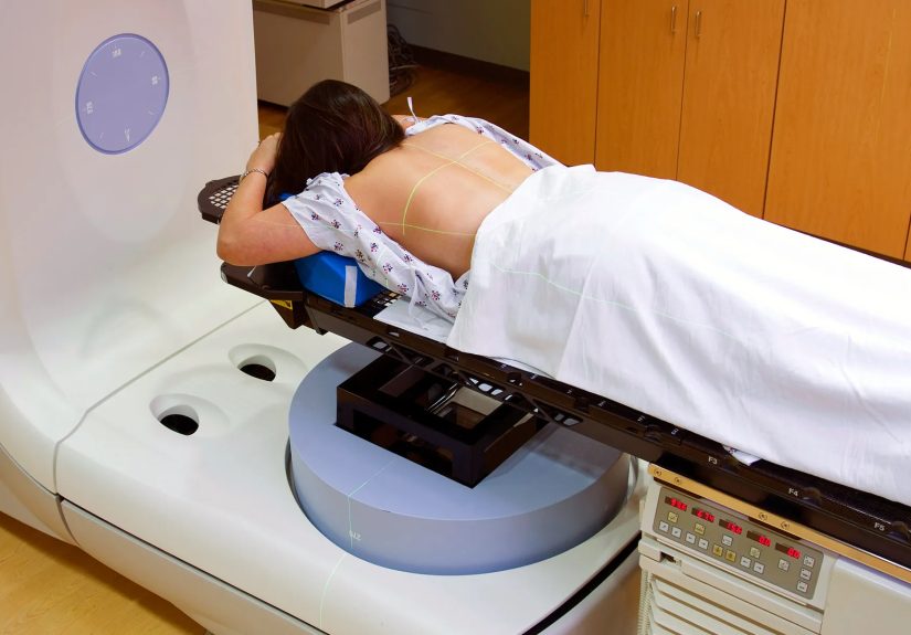 Radiation Therapy: What to Expect