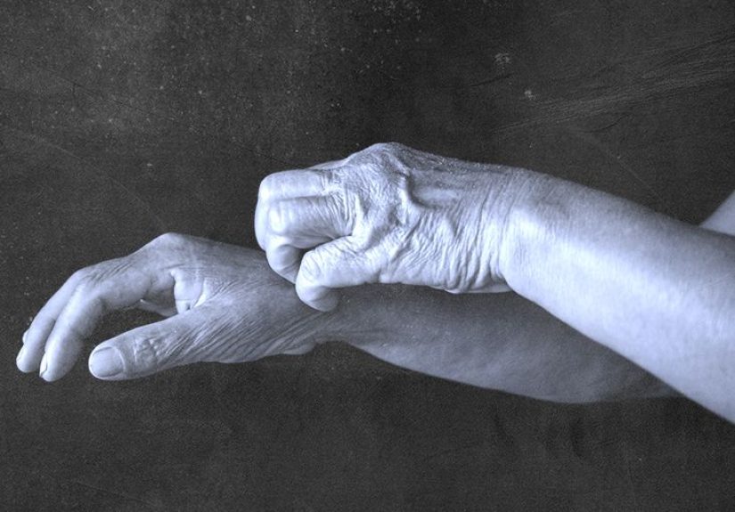 Scabies: Pictures, Causes, Treatment, and More