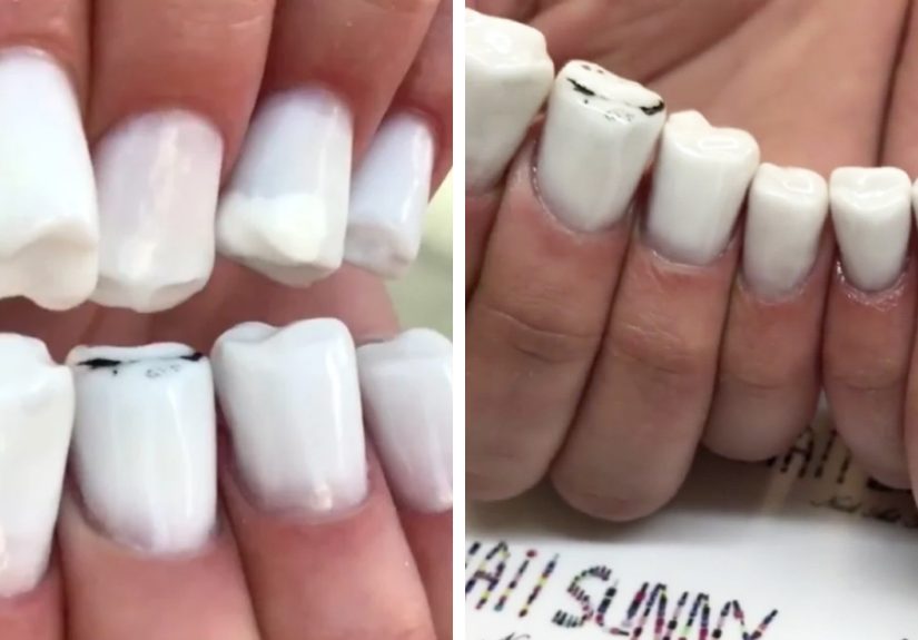 Teeth-Nails Exist, And If You Think They Can’t Get Any Worse, Watch This Video