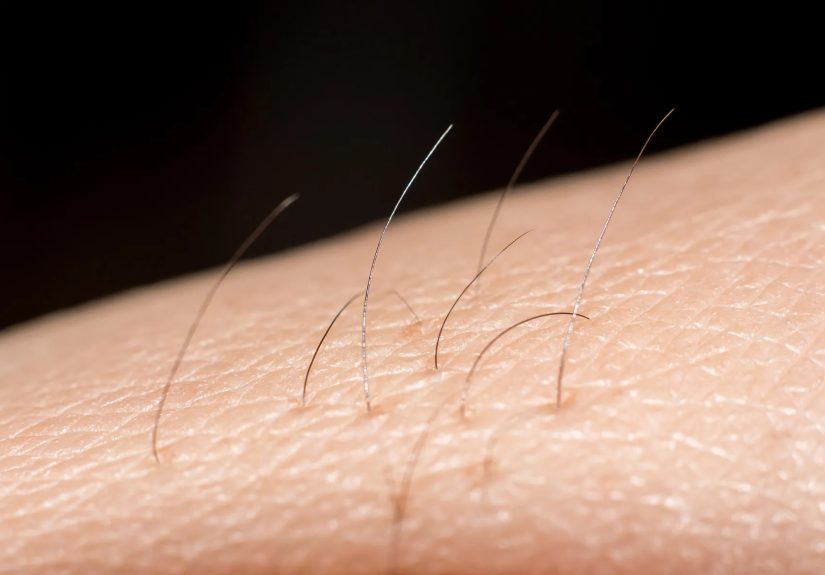 What’s the Best Way to Remove Unwanted Hair?