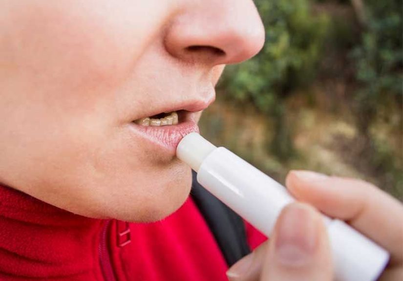 Actinic Cheilitis: Symptoms, Treatment, Prevention, and More