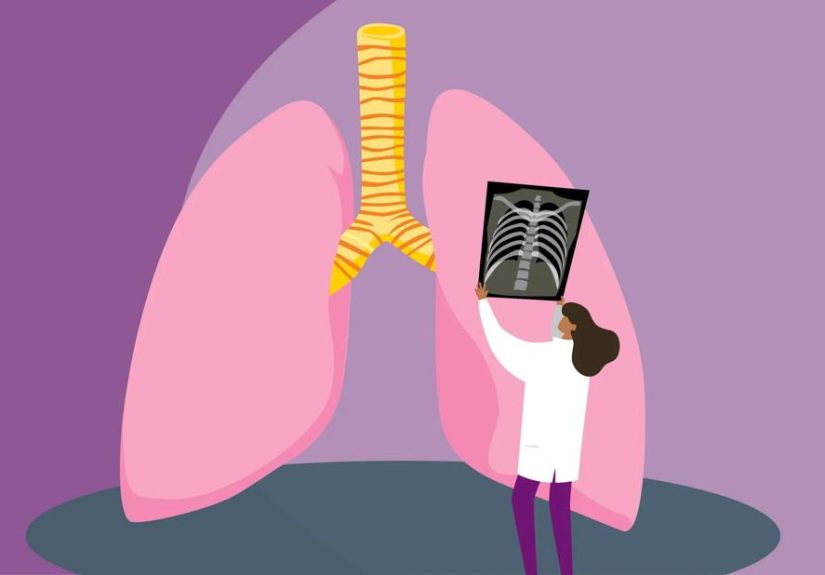Bronchitis vs. Pneumonia: How To Tell the Difference