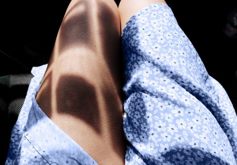 Cellulitis healing stages: Signs and timeline for recovery