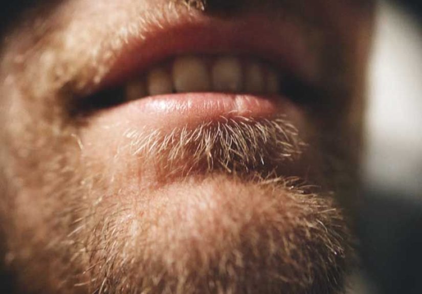 Cracked Tooth: Symptoms, Treatments, and Recovery