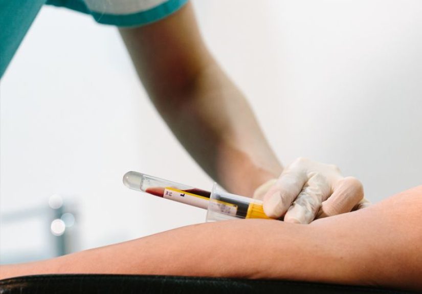 Heart Disease: “Good” HDL Cholesterol May Not Predict Risk