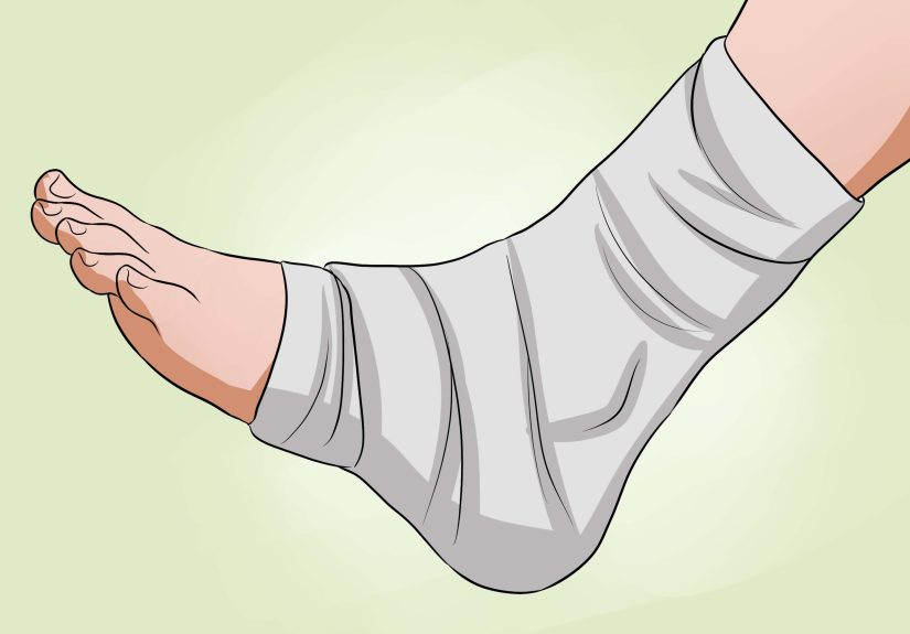 How to Soothe a Sore Ankle: 13 Steps