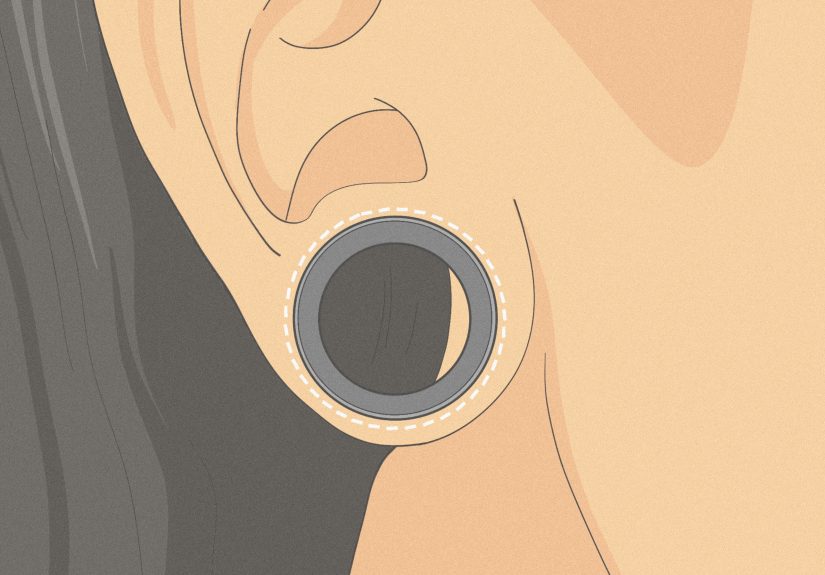 How to Stretch an Ear Lobe Piercing: A Simple and Safe Guide