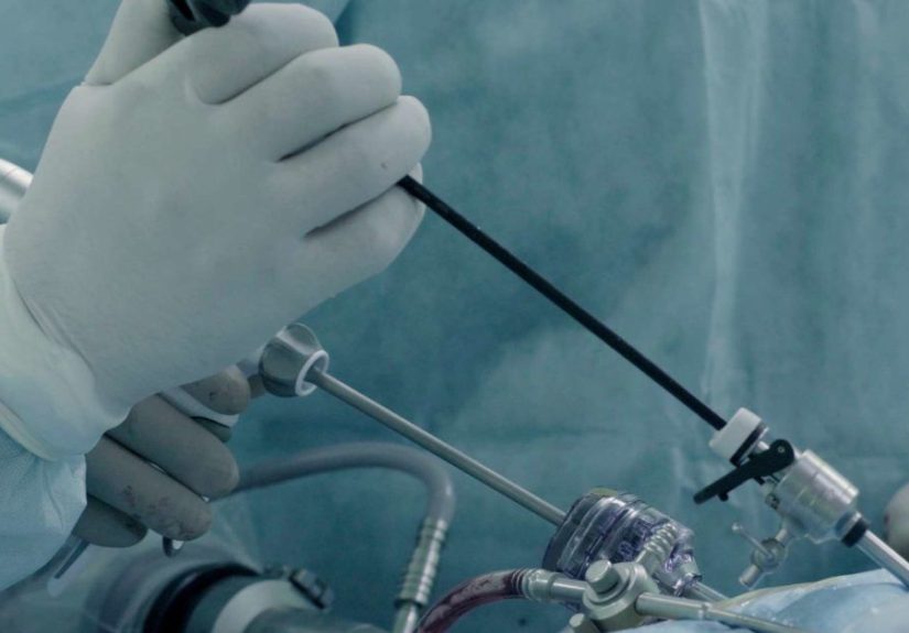 Laparoscopy (Pelvic): Uses, Risks, and Benefits