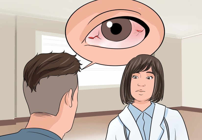 3 Ways to Remove Stuck Contact Lenses