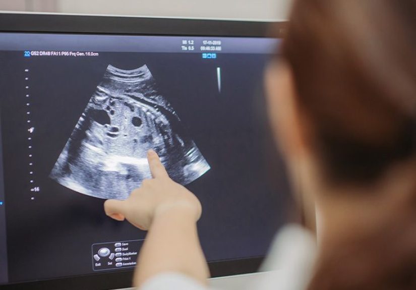 Complex ovarian cyst: Symptoms, risks, pictures, surgery
