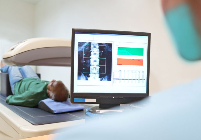 DXA Scan (Bone Density Test): What Is It & How It's Done