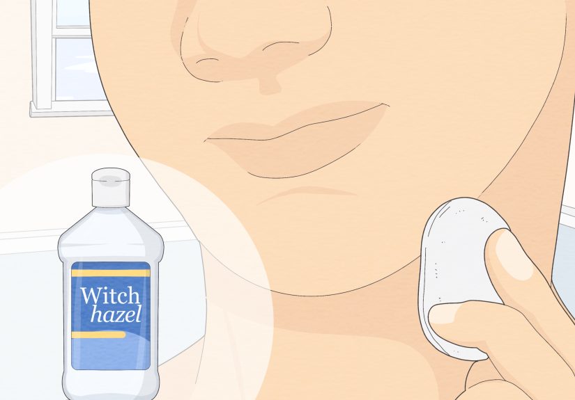 How to Get Rid of Razor Bumps on Your Neck: 13 Easy Remedies