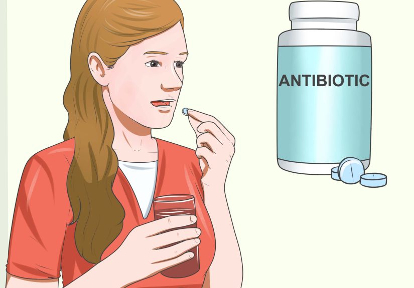 How to Treat Morgellon's Disease: 11 Steps