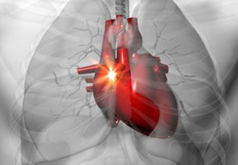 Hyperlipoproteinemia: Types, Symptoms, and Treatments