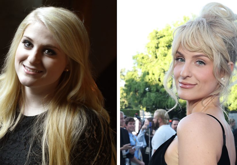 Meghan Trainor’s “Before And After” Photos Reveal More Than Just Weight Loss