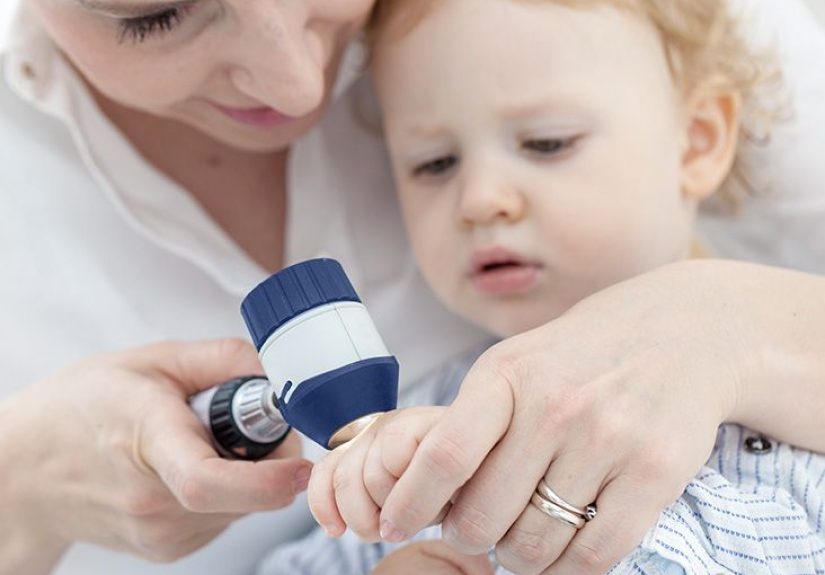 Roseola vs. Measles Rash: What Is the Difference?